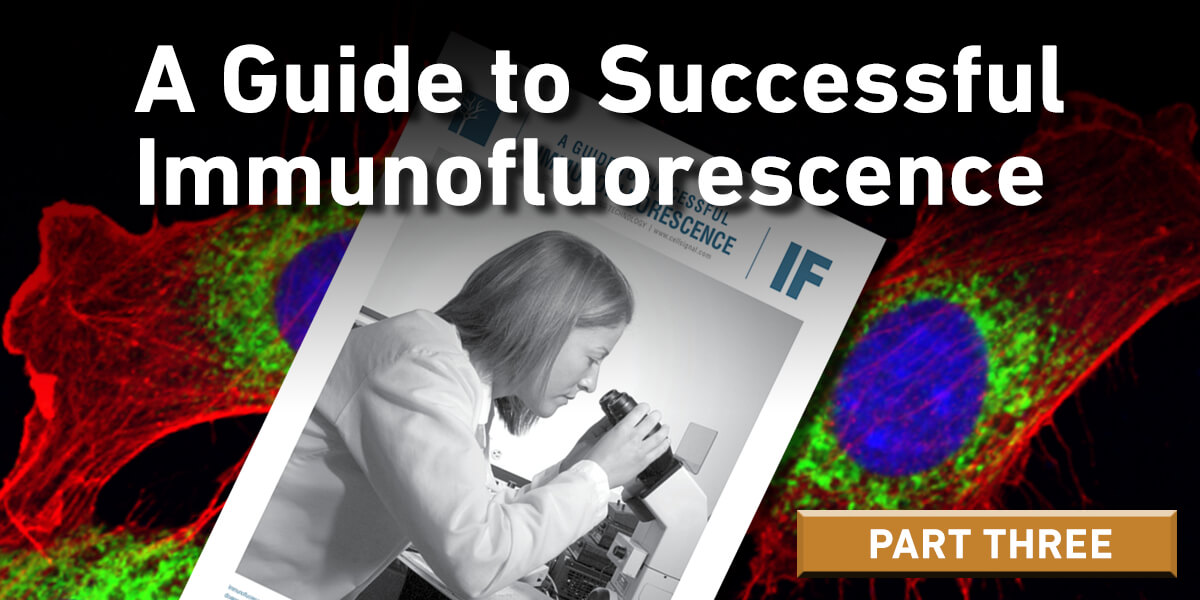 Successful Immunofluorescence Fixation and Permeabilization