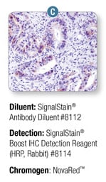 SignalStain® Boost IHC Reagent #8114