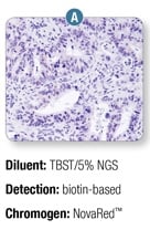 IHC Antigen Retrieval