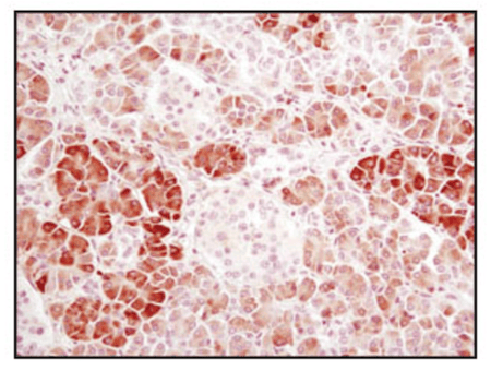 IHC analysis of alpha-amylase