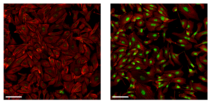 23-BPA-25500_Fig 5_IF analysis of TGF-β1-induced SMAD23 phosphorylation