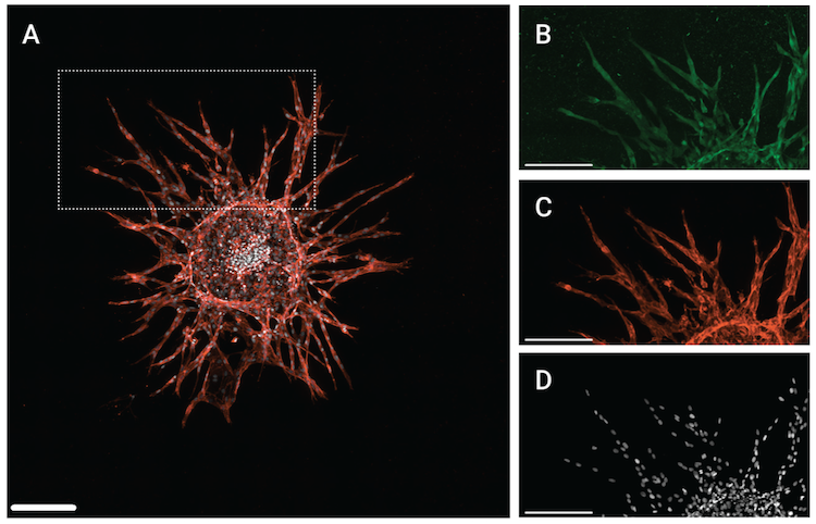 23-BPA-25500_Fig 6_SMAD4 3D sprouting angiogenesis model