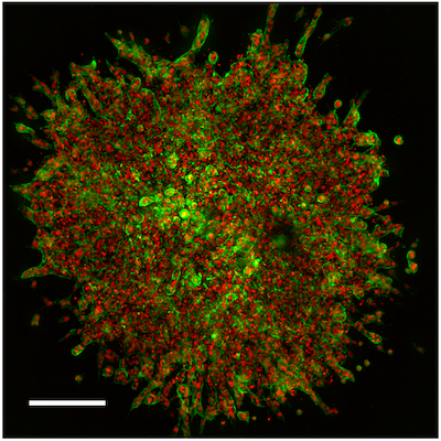 3D angiogenesis sprouting assay