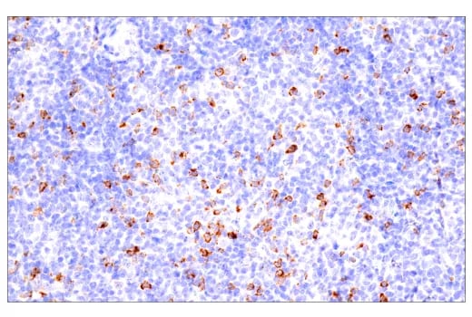 IHC analysis of B-cell non-Hodgkin lymphoma using CTLA-4 on the Leica BOND