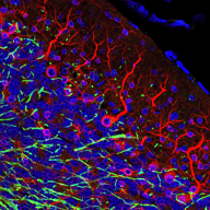 Autophagic-Lysosomal Pathway in Parkinsons_poster thumbnail