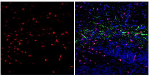 IF analysis of mouse hippocampus using Olig2