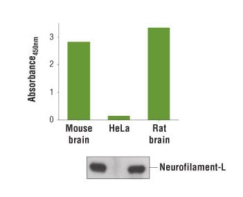 Antibody detection of Neurofilament-L protein, a neuronal marker