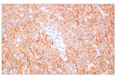 Immunohistochemical analysis of paraffin-embedded Renca syngeneic tumor using Pan-Keratin MultiMab® Rabbit Monoclonal Antibody mix.