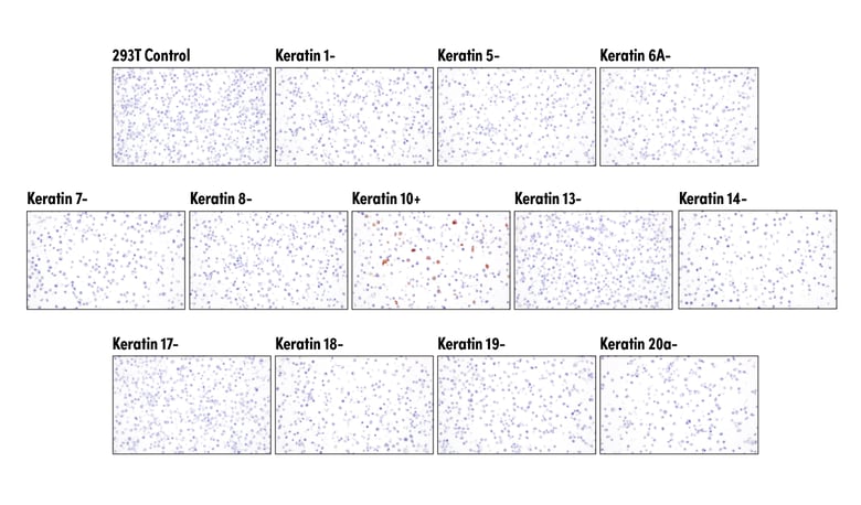 _4545_ihc_Keratin(C11)_Blog_fig1_web