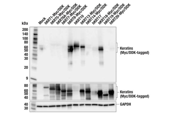 Images showing how the Pan-Keratin (C11) Mouse Monoclonal Antibody #4545 recognizes several keratins in western blot analysis, but only Keratin 10 using IHC. 