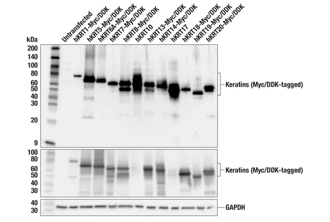 Image of western blot analysis of a panel of keratin using the Pan-Keratin MultiMab® Rabbit Monoclonal Antibody mix #96963. 