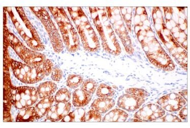 Immunohistochemical analysis of paraffin-embedded mouse colon using Pan-Keratin MultiMab® Rabbit Monoclonal Antibody mix.