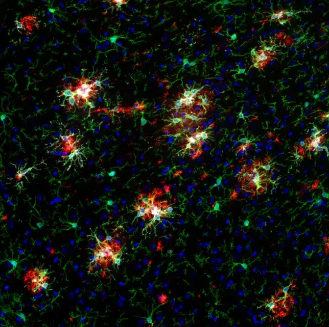Confocal image of amyloid mouse brain showing Iba1-positive microglia in green, beta-amyloid in red, Dectin-1 in gray, and nuclei in blue.