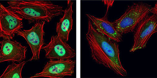 IF analysis showing stress granule formation after UV treatment-1