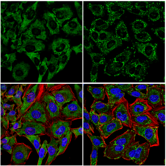 IF analysis showing stress granule formation after sodium arsenite treatment using UBAP2L