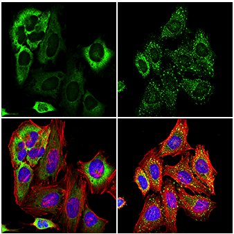 IF analysis showing stress granule formation after sodium arsenite treatment using G3BP1 