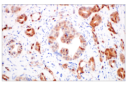 IHC analysis prostate using p16 INK4A