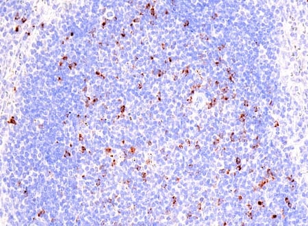 IHC human B-cell non-Hodgkin lymphoma using CTLA-4 