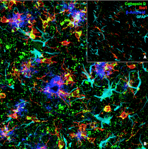 Immunofluorescent analysis of Cathepsin D_SfN Recap