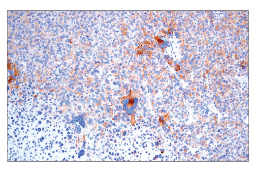 Immunohistochemical analysis of paraffin-embedded Renca syngeneic tumor using CD40 (E2Z7J) Rabbit mAb