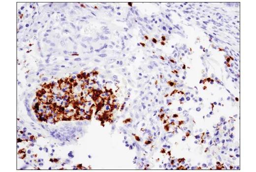 93668_fig01_IHC-Bond_1444