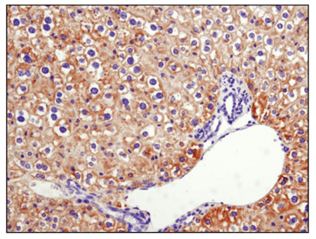 IF analysis of Phospho-Acetyl-CoA Carboxylase