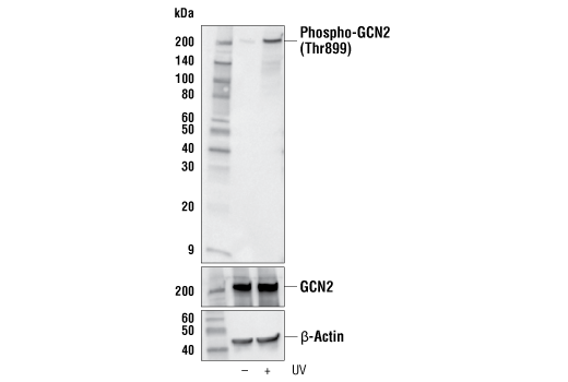 PhosphoPlus GCN2 (Thr899) Antibody Duet Pair