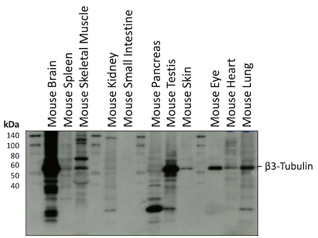 WB analysis mouse tissues beta3-tubulin
