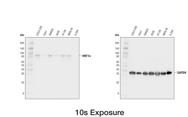 HNF1A-GAPDH-10-+-83-sec_c.gif
