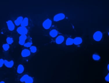 OVCAR8 cells with mycoplasma contamination