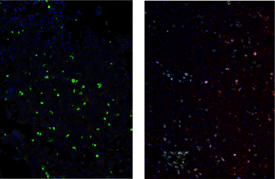 Multiplexed IHC analysis of mouse glioblastoma tumor