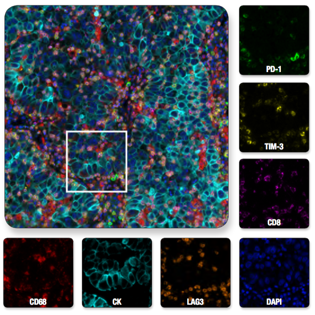 mIHC T cell exhaustion Fig 2