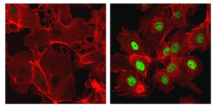 CST Antibody: HIF-1α (D1S7W) XP® Rabbit mAb 