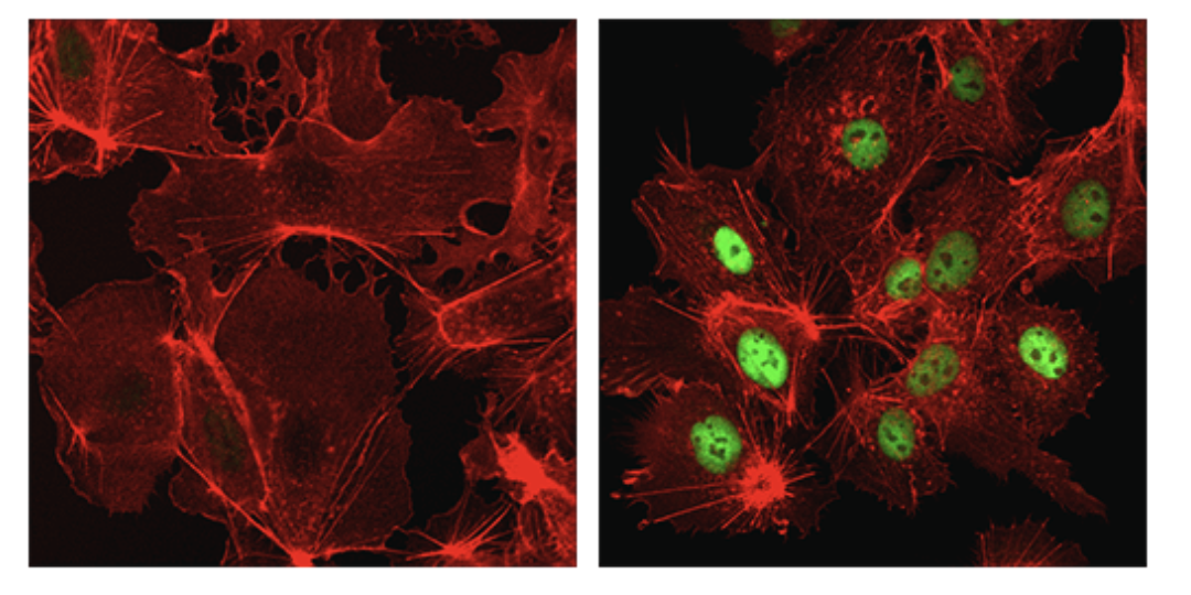 CST Antibody: HIF-1α (D1S7W) XP® Rabbit mAb 