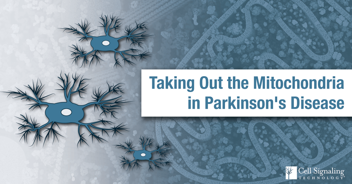 19-PRO-92632-Parkinson-Proteomics-Blog-1600x800