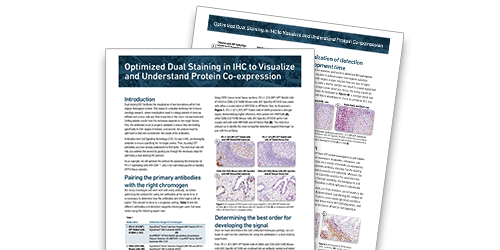 Dual Staining IHC EMT