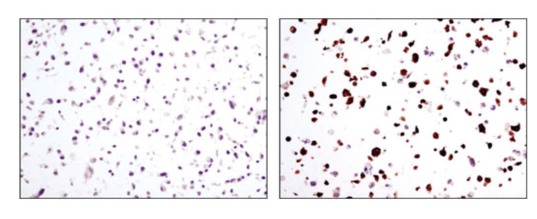 Immunohistochemical analysis of paraffin-embedded COS cell pellets, control (upper) or transfected with a carboxy-terminal Myc tagged protein (lower), using Myc-Tag (9B11) Mouse Monoclonal Antibody #2276.