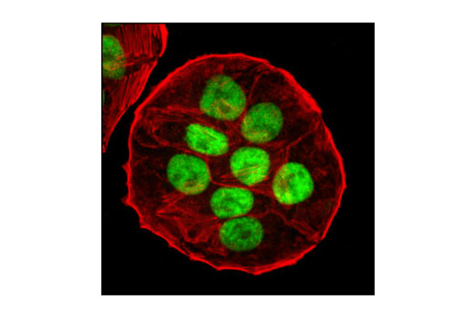 Confocal Immunofluorescent analysis of HT-29 cells