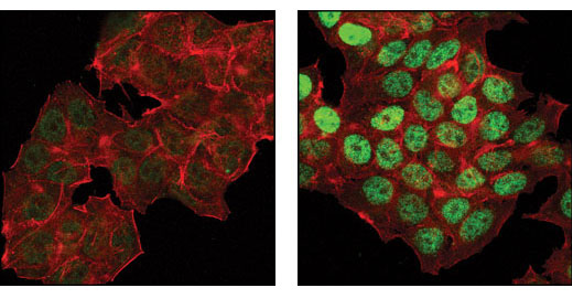Confocal immunofluorescent analysis of MCF-7 cells,