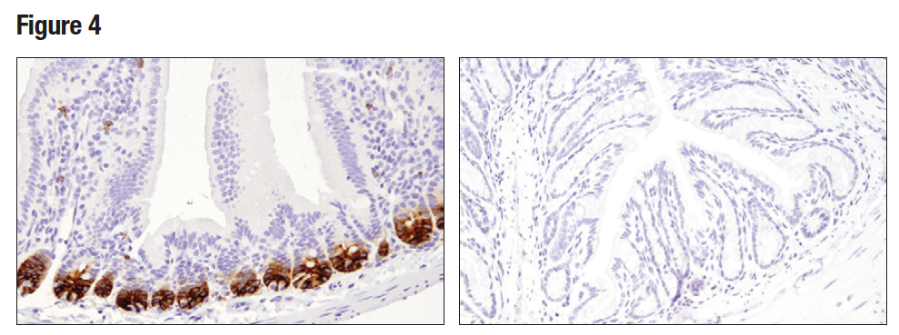 IHC analysis of paraffin-embedded normal mouse small intestine (left) and colon (right) using Olfm4 (D6Y5A)