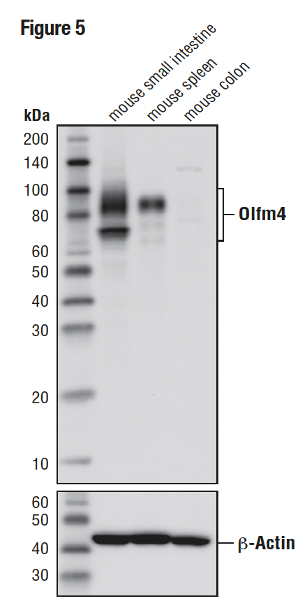 WB analysis of extracts from mouse small intestine (positive), mouse spleen (positive), and mouse colon (negative) using Olfm4 (D6Y5A) (upper)