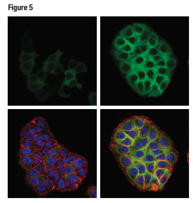 Confocal ICC analysis of HT-29 cells using RRM2 (E7Y9J)