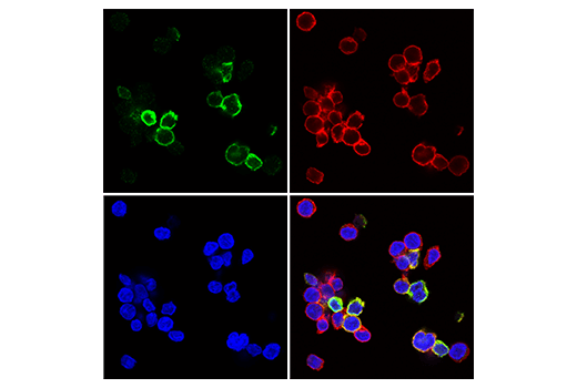 Co-expression of purified human T cells with CD8 (red) and TIGIT (green).