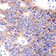 IHC-validated Claudin-6 recombinant monoclonal antibody_Square