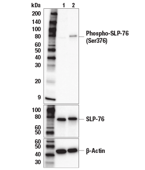 Western blot analysis of jukat cells treated with Human Anti-CD3/CD28 T Cell Activation Kit #70976