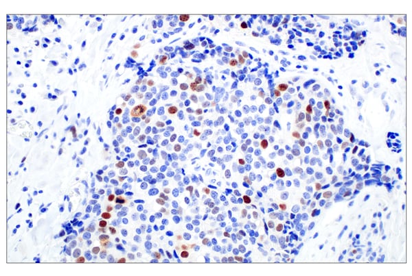 BRCA1 (E5S9G) Rabbit mAb #50799