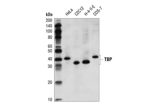 TBP Antibody_Western Blot Loading Control