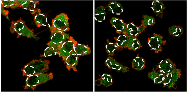 IF analysis of NF-κB p65 and CD45 in iPSC-derived microglia