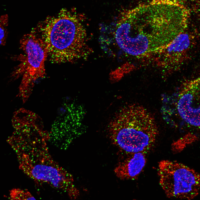immunofluorescence analysis of TREM2 signaling in iPSC iCell Microglia