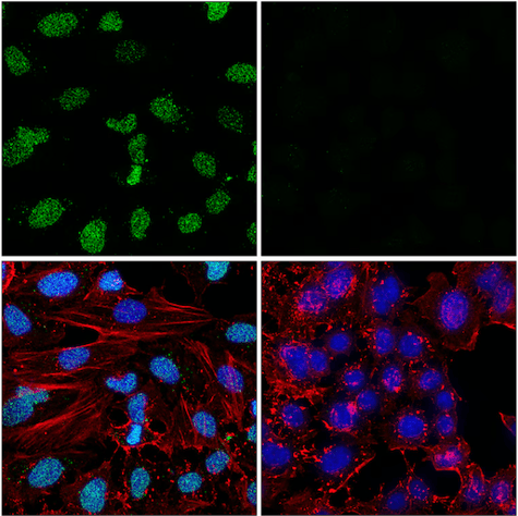  PARylation PTM antibody